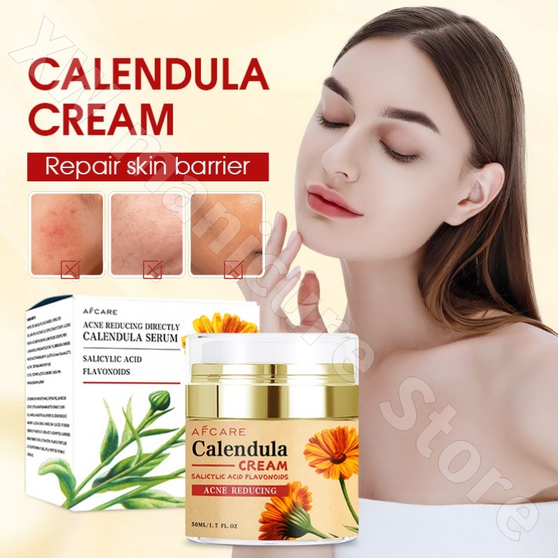 Luxury Skincare Whitening Cream - Восстанавливающий крем-календула, увлажняющий и омолаживающий кожу,